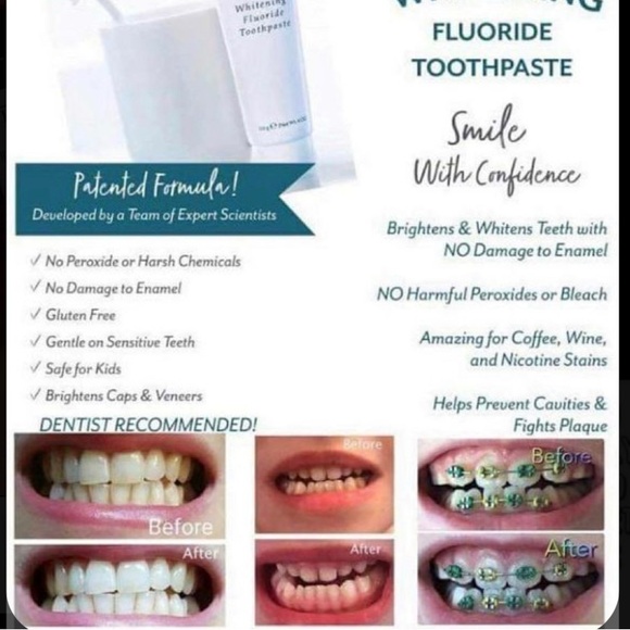 Whitening Toothpaste - Picture 9 of 9